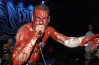 HAEMORRHAGE